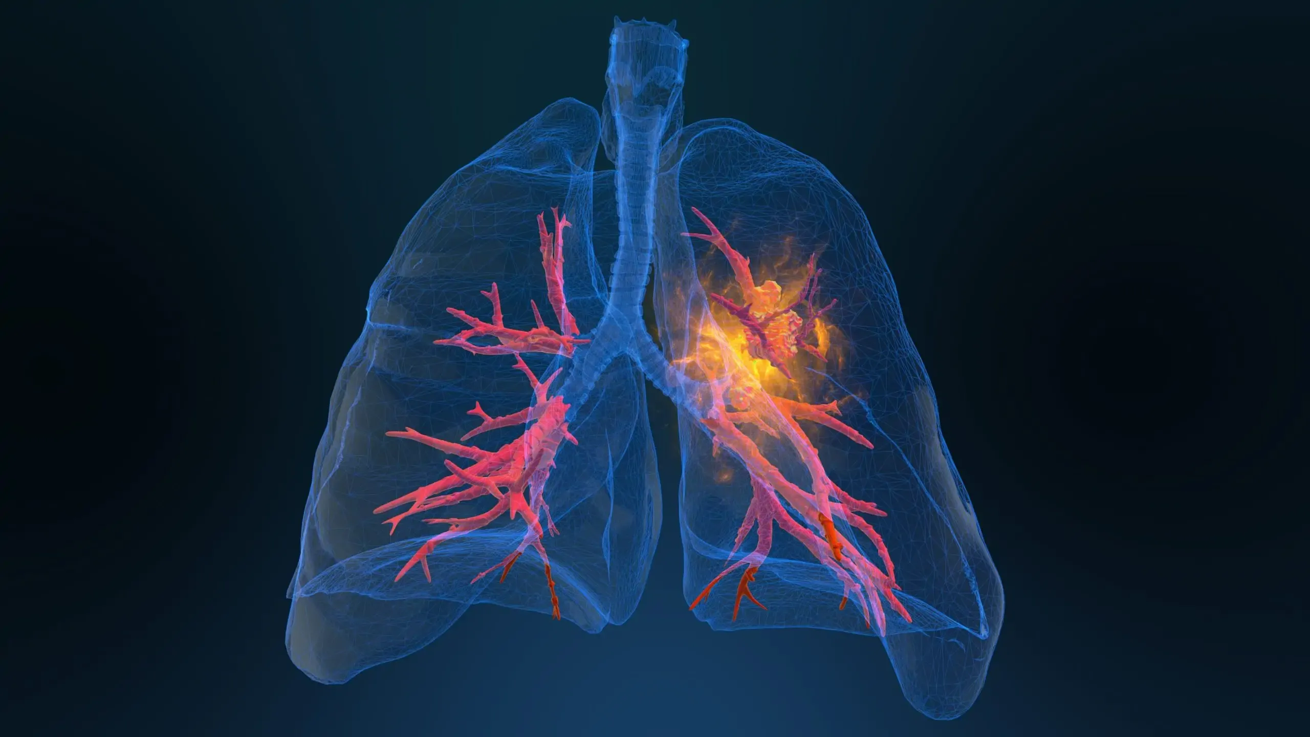 pulmonary hero